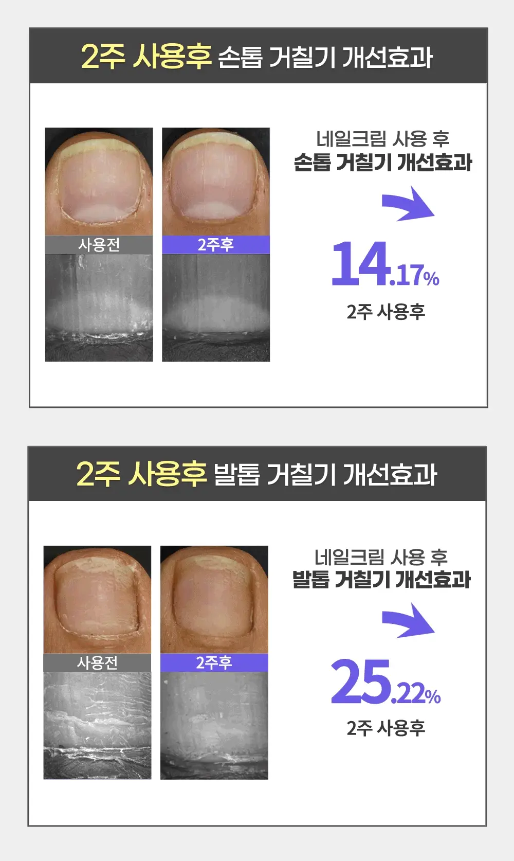 [큐티클간편케어] 코스노리 실크리페어 네일 크림 손톱영양제 상세페이지 14